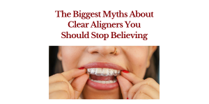 Clear Aligners